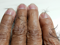 Fingernails and Hair Keep Growing  After Death